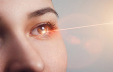 Refractive Surgery